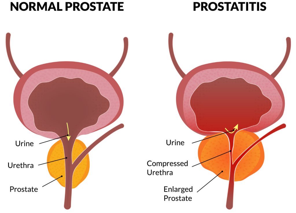 healthy prostate